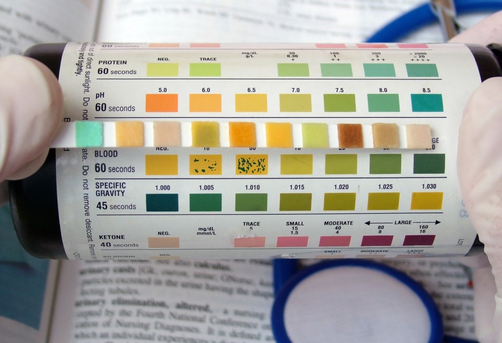 urine ph test — Get Your Lean On