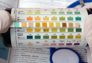 Myth #4: You Can Test Your Urine to Determine Whether You’re Acidic